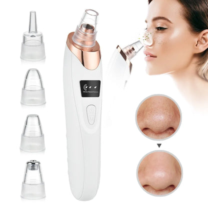 Blackhead Remover Vacuum Acne Pimple Black Spot